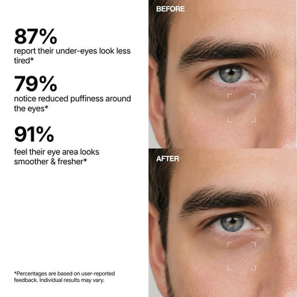 Eye Rescue Eye Serum
